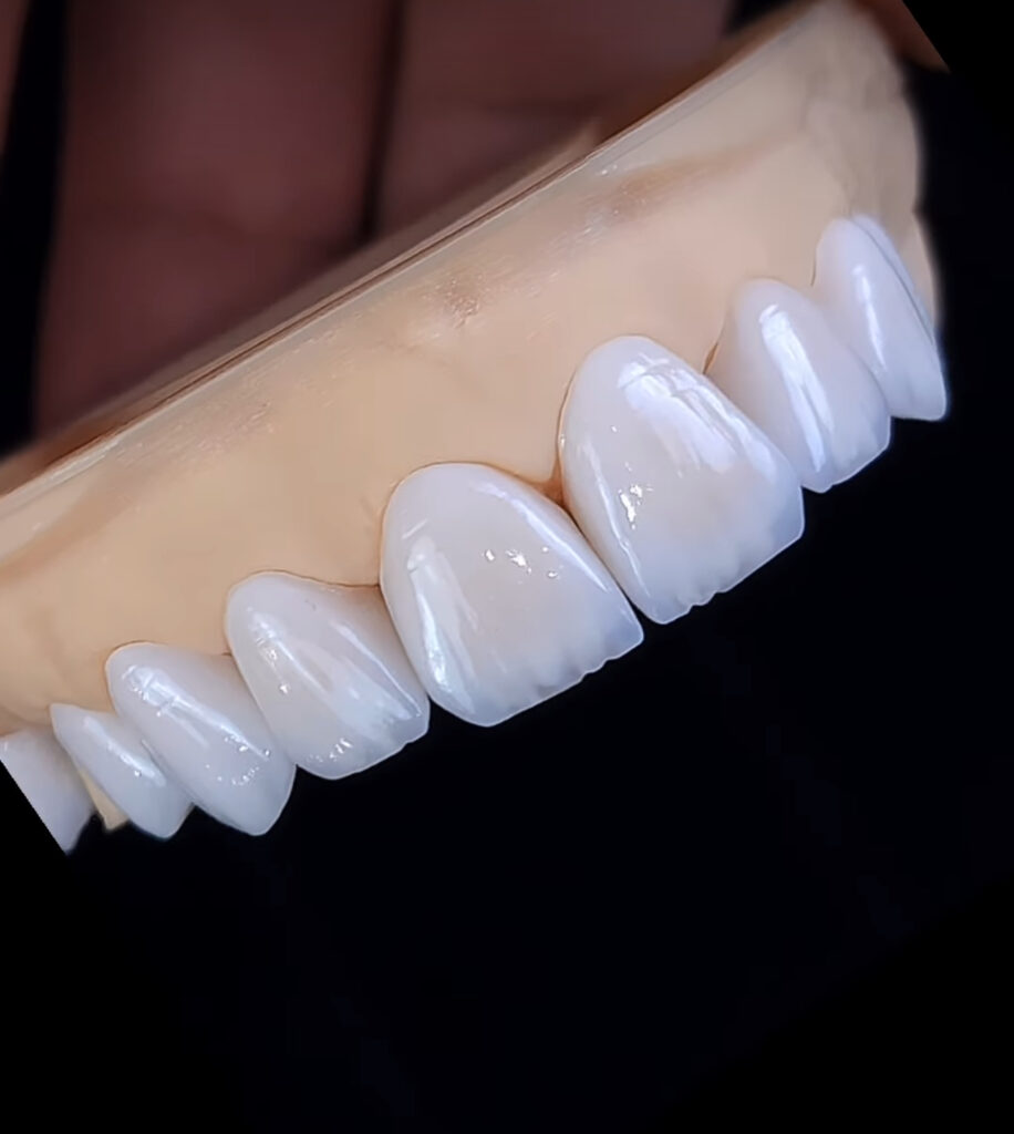 Affordable cosmetic dentistry